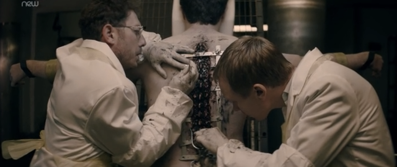 Illustration for article titled In The Flesh Reveals The Horrors Behind The Zombie Cure